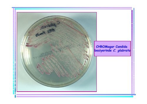 candıda türlerinin kromojenik besiyerleri ve moleküler yöntemlerle ...