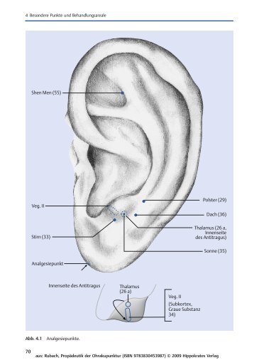 Hippokrates: PropÃ¤deutik der Ohrakupunktur - Buchhandel.de