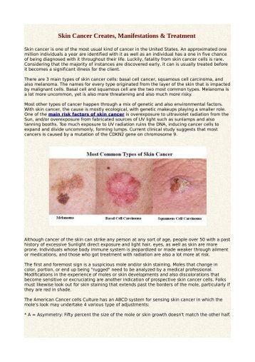 Skin Cancer Creates, Manifestations & Treatment