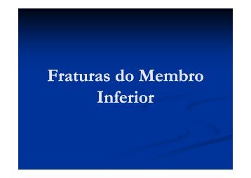 Fraturas de Membro Inferior.pdf
