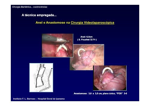 Cirurgia BariÃ¡trica - visÃ£o crÃ­tica - Academia Nacional de Medicina