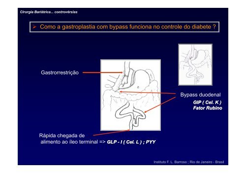 Cirurgia BariÃ¡trica - visÃ£o crÃ­tica - Academia Nacional de Medicina