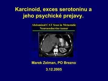 zelman 2005 karcinoid, exces serotoninu a jeho psychicke prejavy.pdf