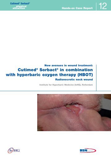 CutimedÂ® SorbactÂ® in combination with hyperbaric oxygen therapy ...