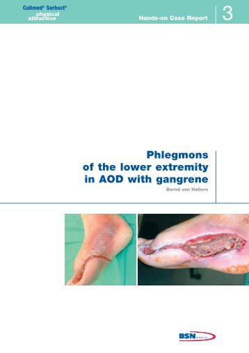 Phlegmons of the lower extremity in AOD with gangrene - Cutimed