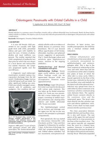 Odontogenic Pansinusitis with Orbital Cellulitis in a Child