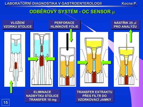 FOBT METODOU OC-SENSOR - Dialab