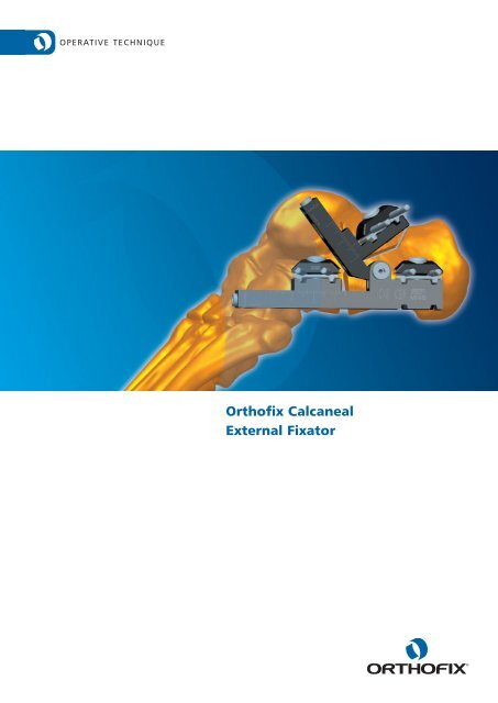 Orthofix Calcaneal External Fixator - Pro-Motion Medical