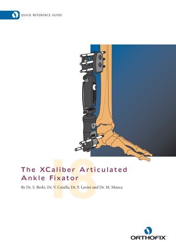 The XCaliber Articulated Ankle Fixator - Orthofix