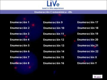 Sonda EnumeraciÃ³n Y - Lexel