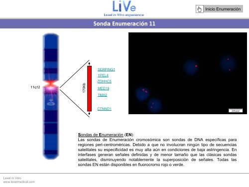 Sonda EnumeraciÃ³n Y - Lexel