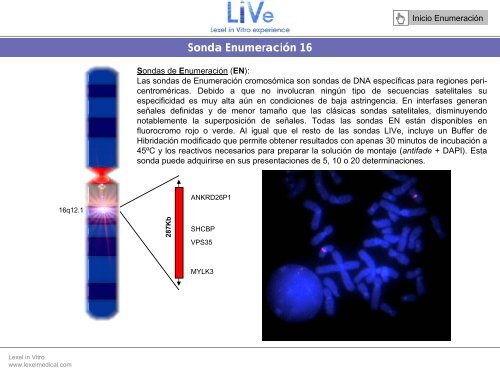 Sonda EnumeraciÃ³n Y - Lexel