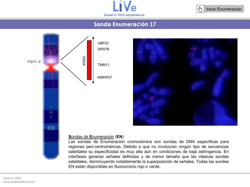 Sonda EnumeraciÃ³n Y - Lexel