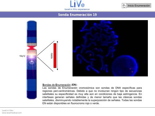 Sonda EnumeraciÃ³n Y - Lexel