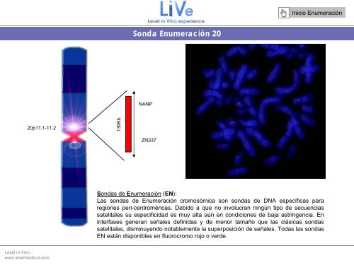 Sonda EnumeraciÃ³n Y - Lexel