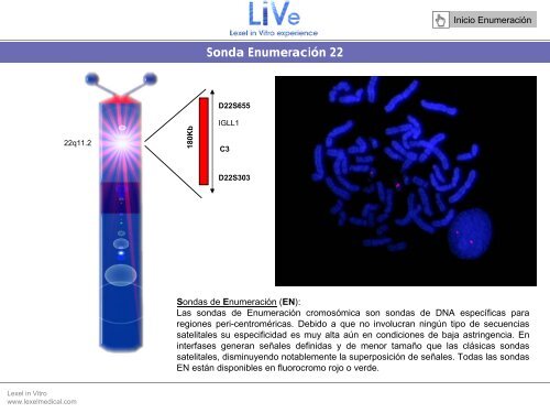 Sonda EnumeraciÃ³n Y - Lexel