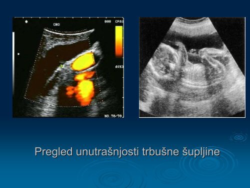 Primjene ultrazvuka u medicini.pdf