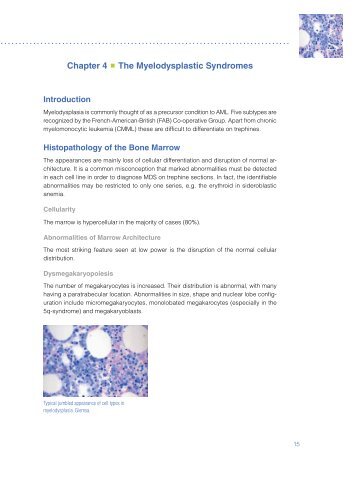 Chapter 4 The Myelodysplastic Syndromes - Dako