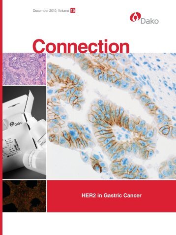 Connection 15 - HER2 in Gastric Cancer - Dako