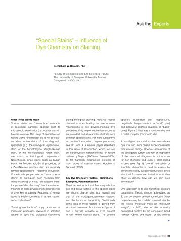 âSpecial Stainsâ â Influence of Dye Chemistry on Staining