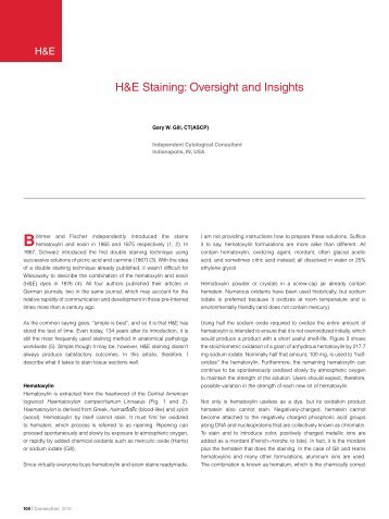 H&E Staining: Oversight and Insights - Dako