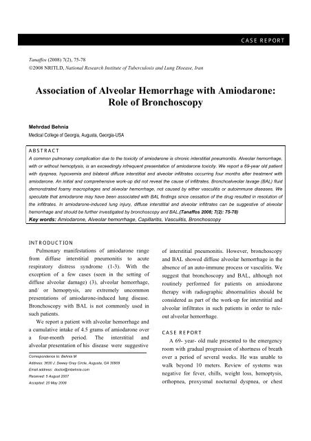 Association Of Alveolar Hemorrhage With Amiodarone