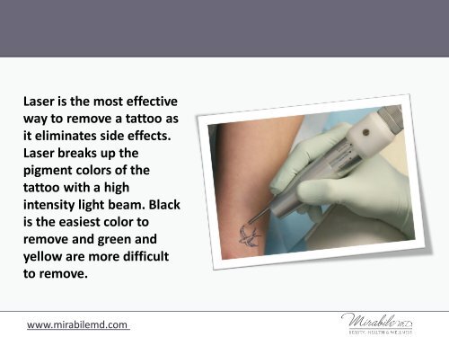 Quick and Permanent Tattoo Removal in Kansas City