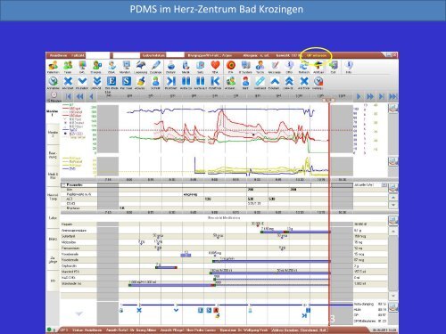 PDMS in der Intensivpflege – ein Praxisbeispiel - Heilberufe