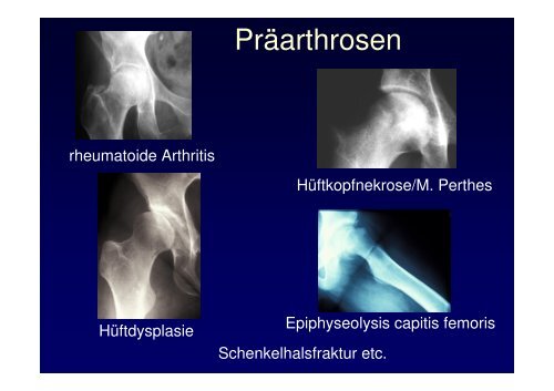 Vorlesung Leitsymptom HÃ¼ftschmerz