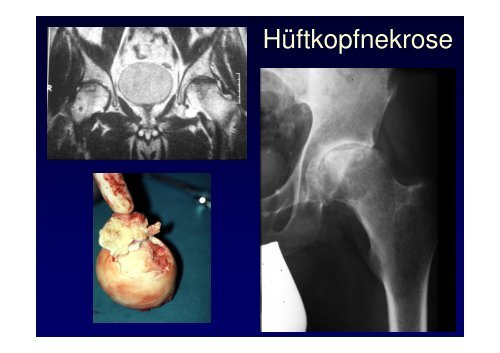 Vorlesung Leitsymptom HÃ¼ftschmerz