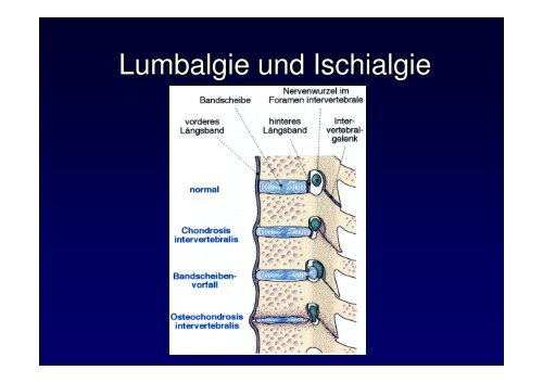 Vorlesung Leitsymptom HÃ¼ftschmerz