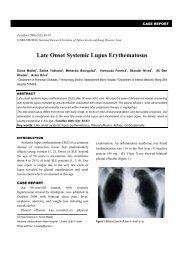 Late Onset Systemic Lupus Erythematosus - Tanaffos