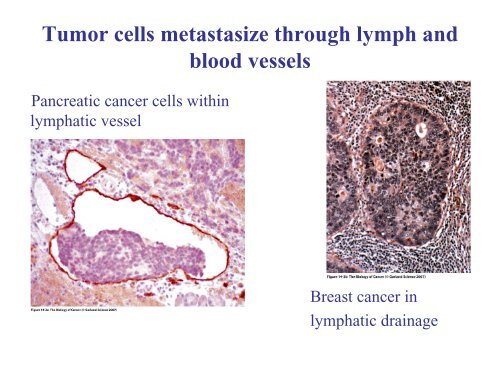 Invasion and metastasis - Experimental Oncology Graduate Study