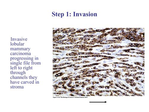 Invasion and metastasis - Experimental Oncology Graduate Study