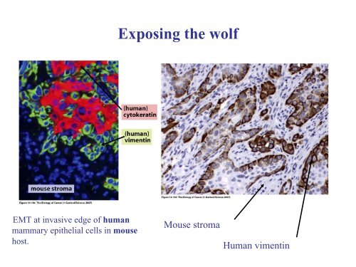 Invasion and metastasis - Experimental Oncology Graduate Study