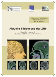 Aktuelle Bildgebung des ZNS: Molecular Imaging für ... - DTZ Berlin