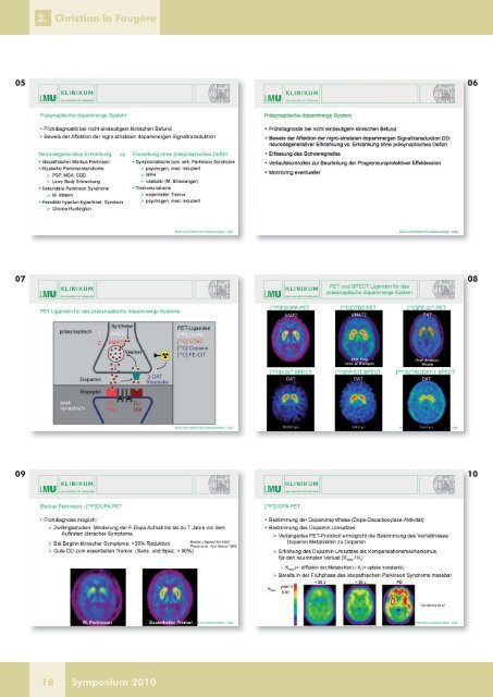 Aktuelle Bildgebung des ZNS: Molecular Imaging für ... - DTZ Berlin