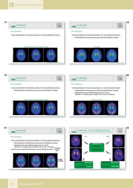 Aktuelle Bildgebung des ZNS: Molecular Imaging für ... - DTZ Berlin