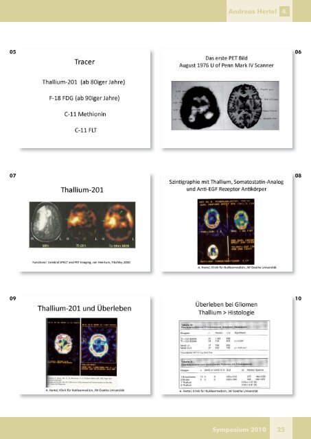 Aktuelle Bildgebung des ZNS: Molecular Imaging für ... - DTZ Berlin