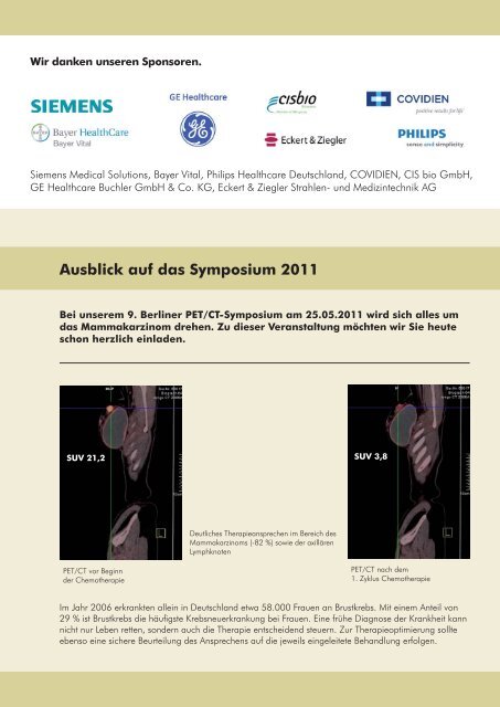 Aktuelle Bildgebung des ZNS: Molecular Imaging für ... - DTZ Berlin