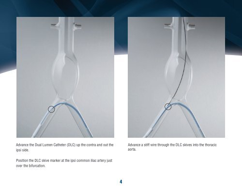 PowerlinkÂ® System for AAA Visiflex SurePass Delivery ... - Endologix