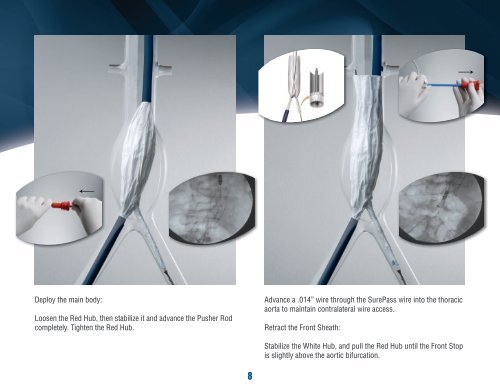 PowerlinkÂ® System for AAA Visiflex SurePass Delivery ... - Endologix