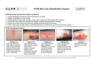 STAR Skin Tear Classification System - Silver Chain