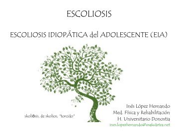 RehabilitaciÃ³n del aparato locomotor: Escoliosis