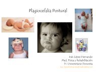 Plagiocefalia - AsociaciÃ³n Vasca de PediatrÃ­a de AtenciÃ³n Primaria