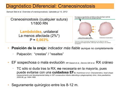 Plagiocefalia - AsociaciÃ³n Vasca de PediatrÃ­a de AtenciÃ³n Primaria