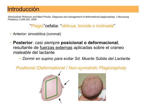 Plagiocefalia - AsociaciÃ³n Vasca de PediatrÃ­a de AtenciÃ³n Primaria