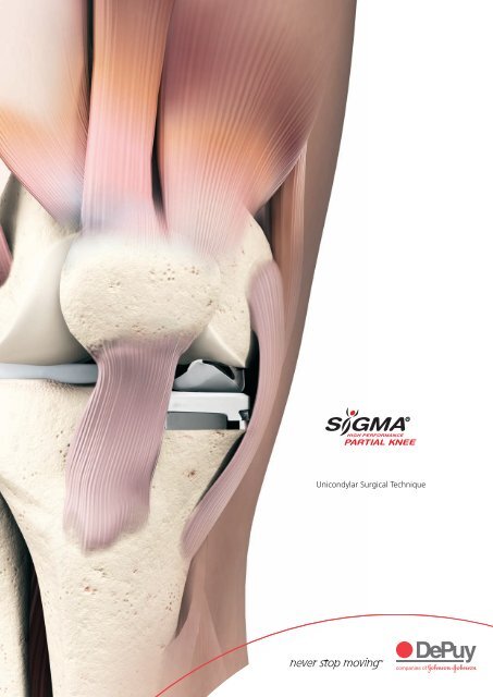 Uni- Condylar Knee Surgical Technique - Yorkshire Joint ...