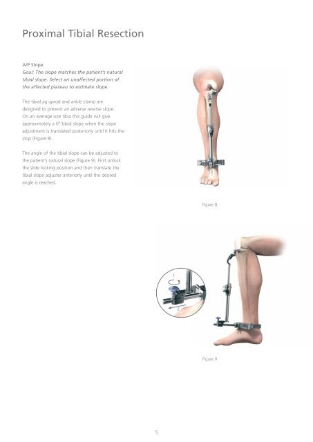 Uni- Condylar Knee Surgical Technique - Yorkshire Joint ...