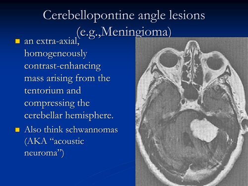 Dizziness: Differential Diagnosis